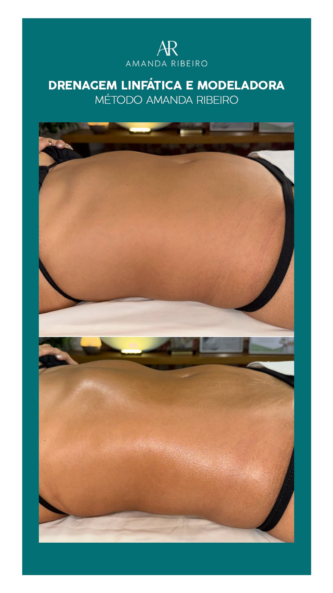 Resultado antes e depois - Drenagem Modeladora