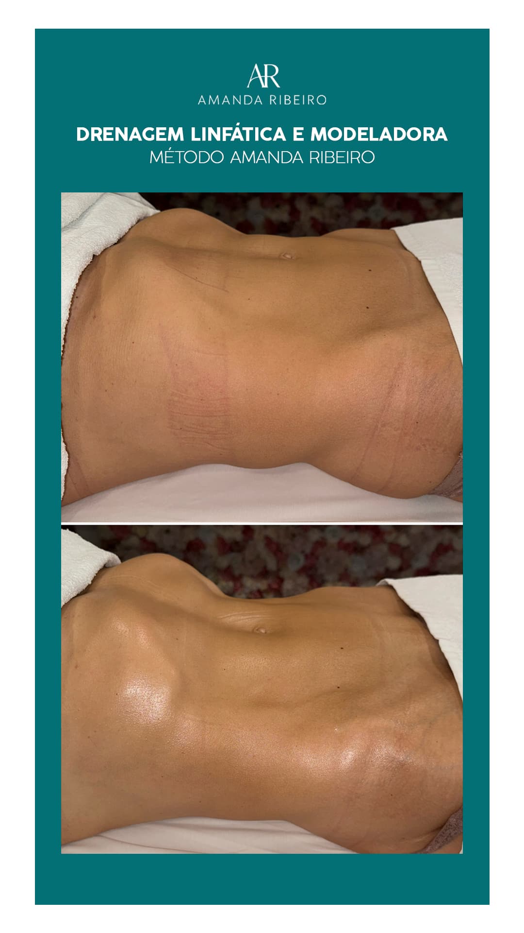 Resultado antes e depois - Drenagem Modeladora