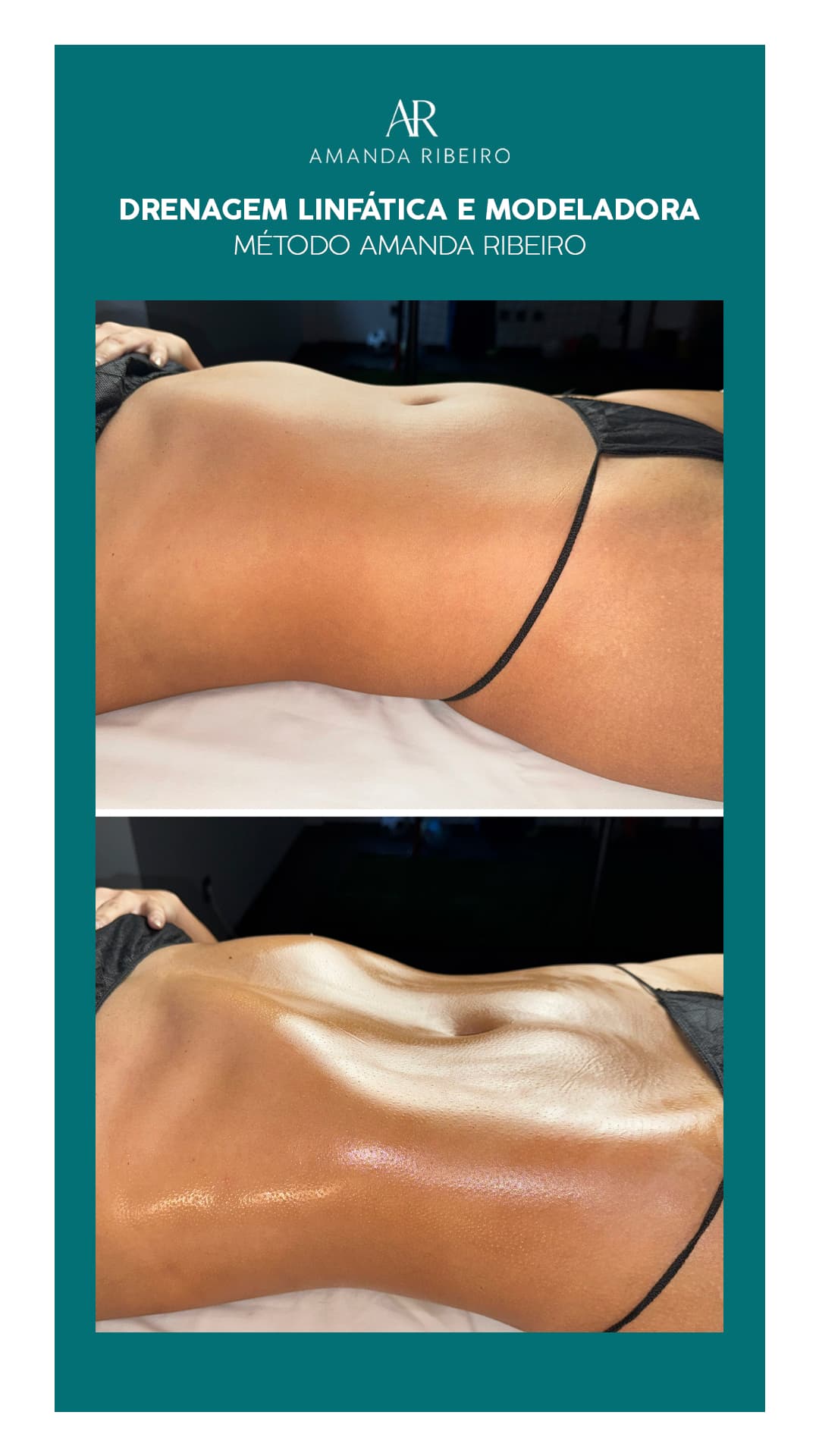 Resultado antes e depois - Drenagem Modeladora