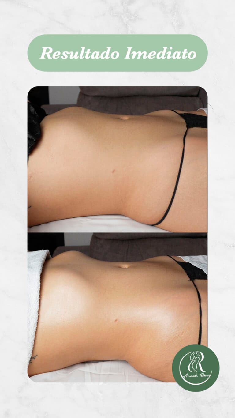Resultado antes e depois - Sessão 1