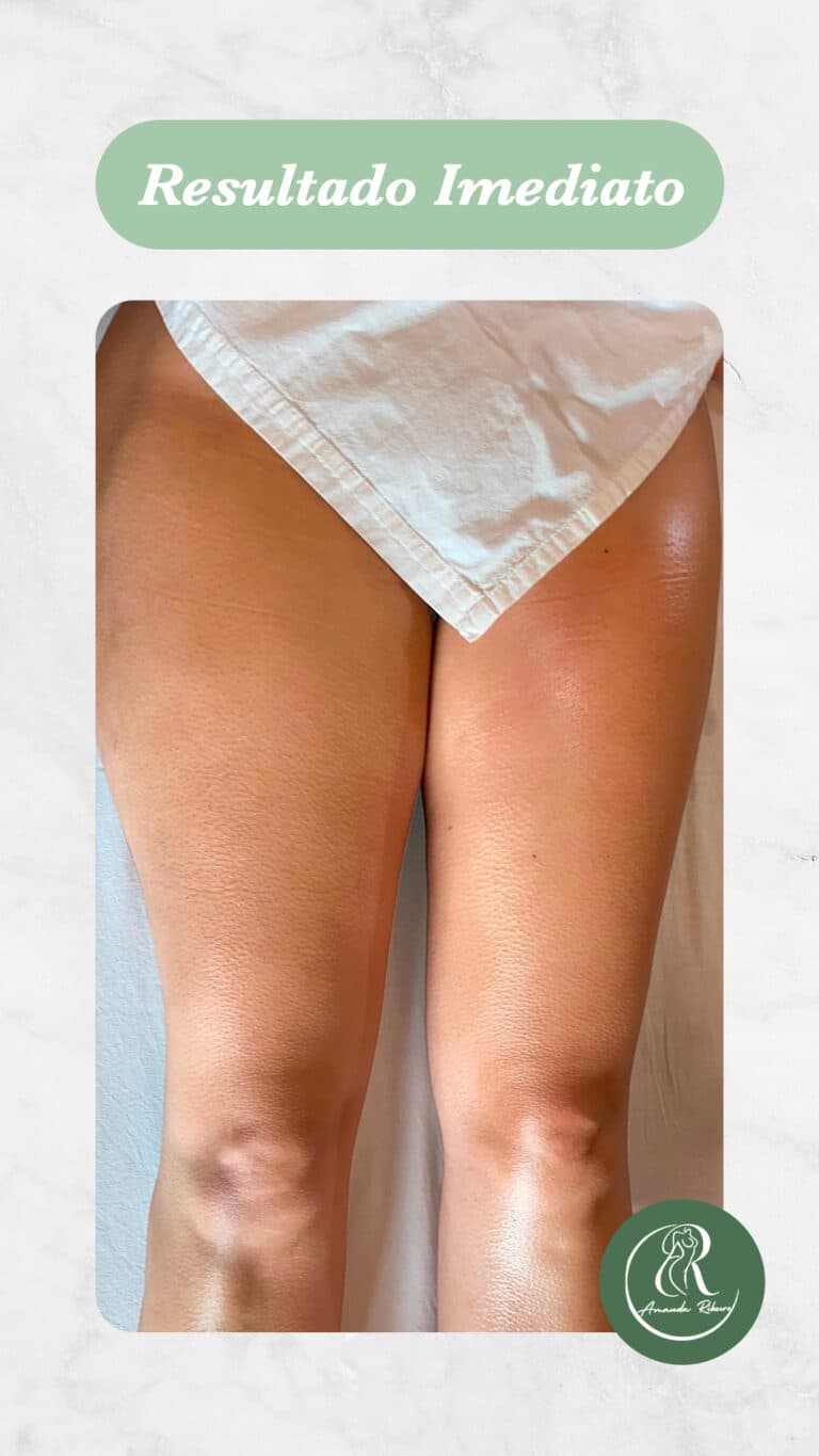 Resultado antes e depois - Sessão 10