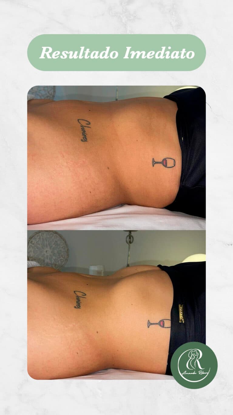 Resultado antes e depois - Sessão 3