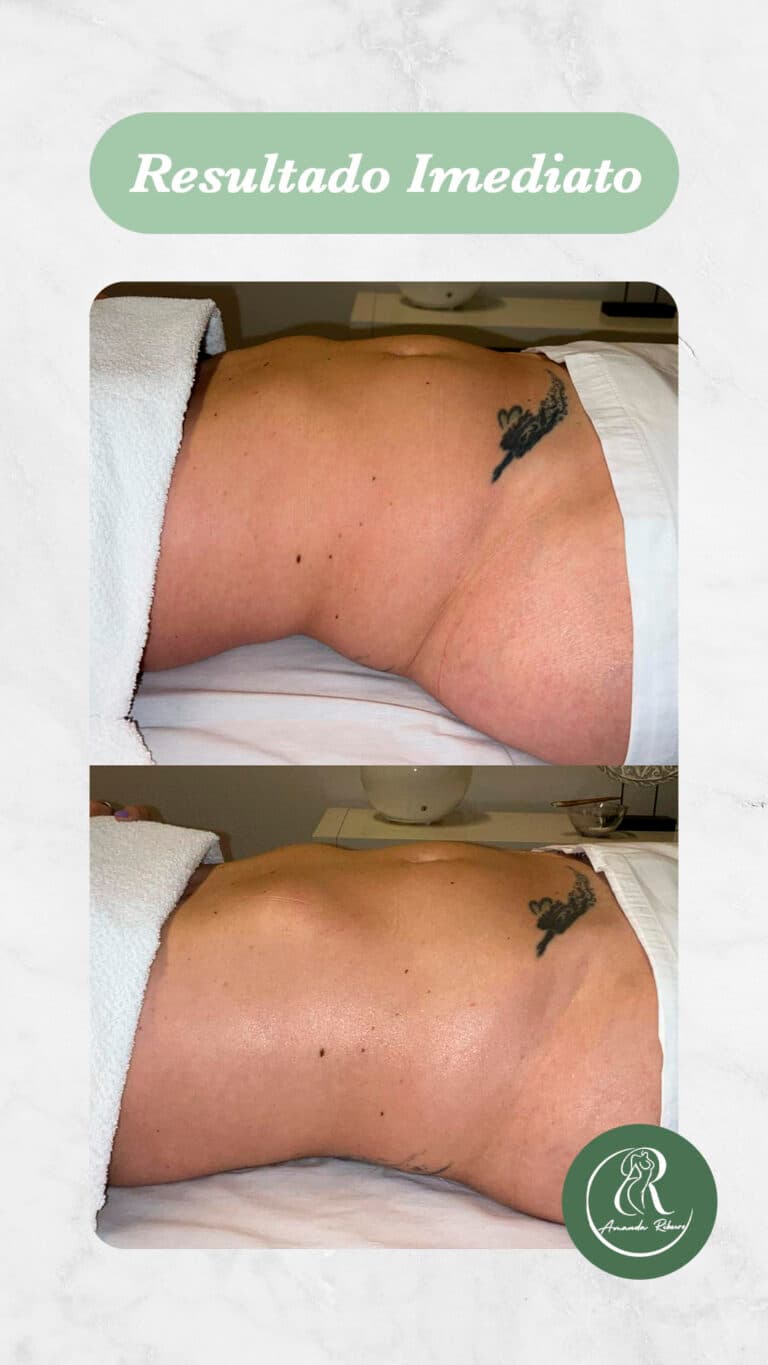 Resultado antes e depois - Sessão 4