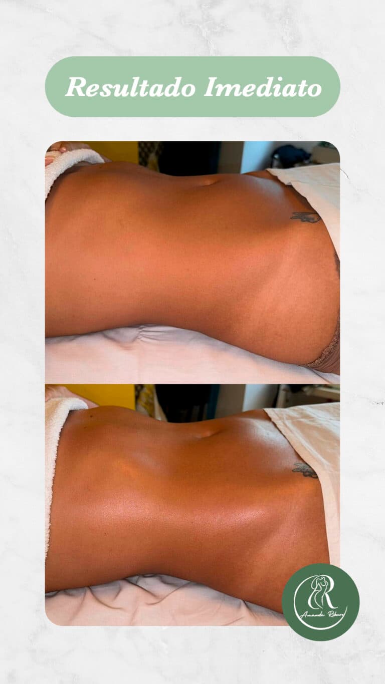 Resultado antes e depois - Sessão 5
