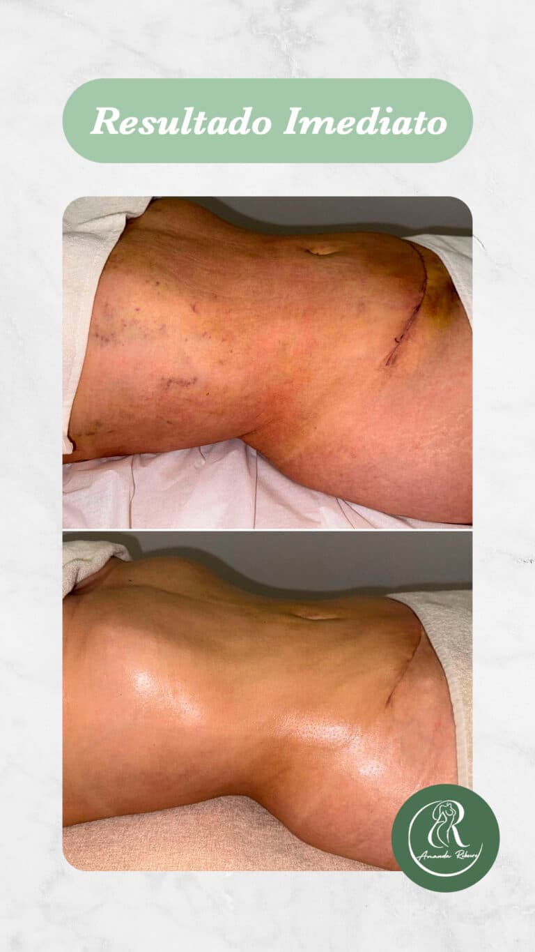 Resultado antes e depois - Sessão 6