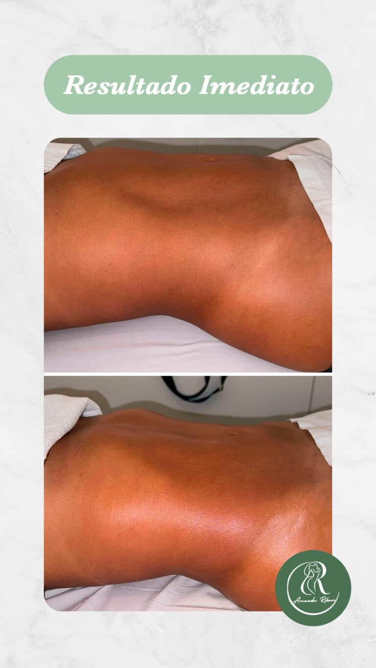 Resultado antes e depois - Sessão 7