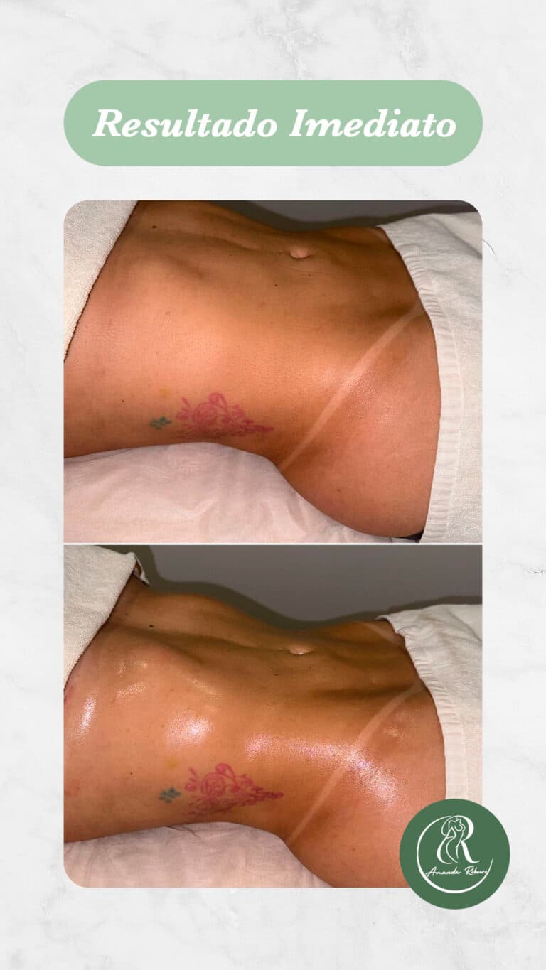 Resultado antes e depois - Sessão 8
