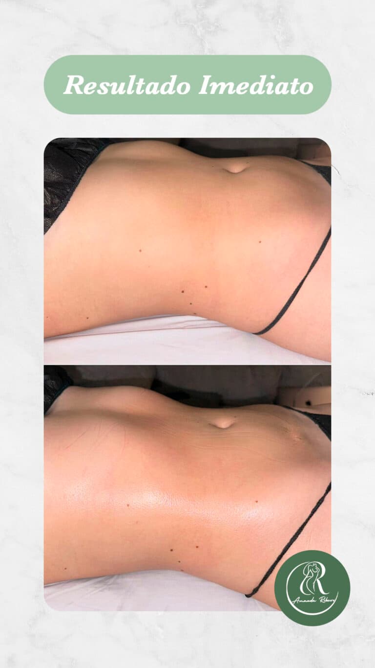 Resultado antes e depois - Sessão 9