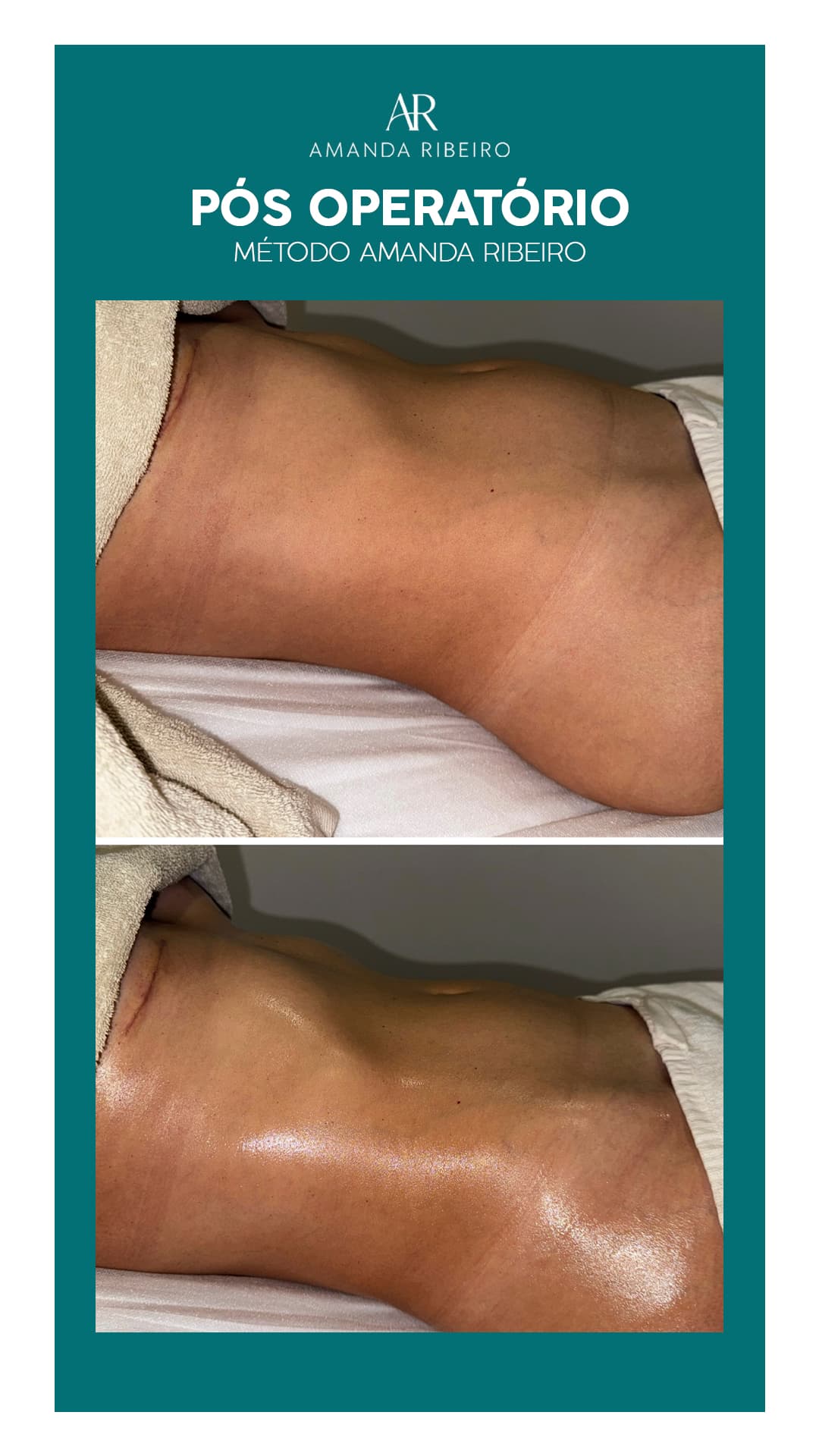 Resultado antes e depois - Pós Operatório