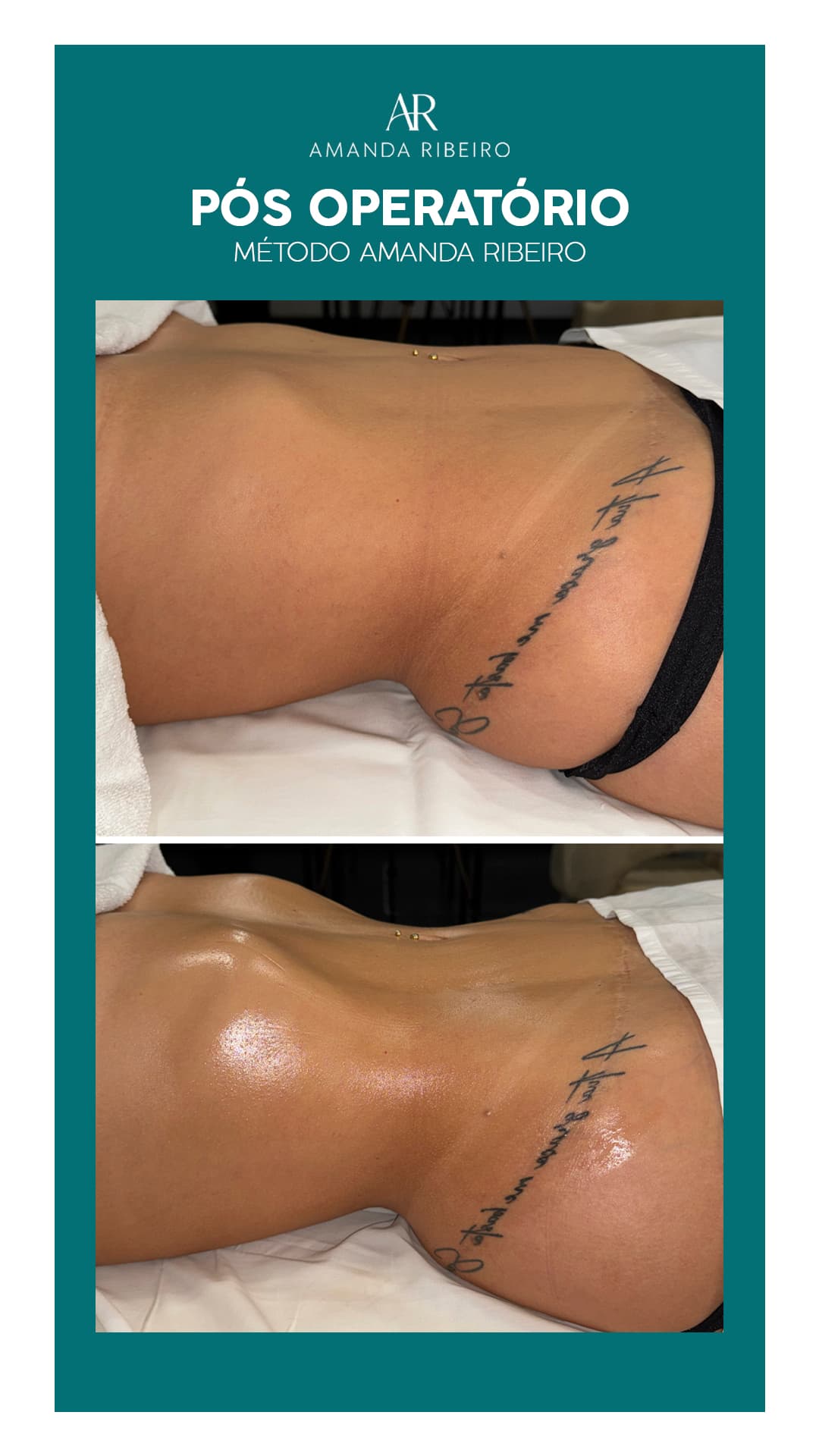 Resultado antes e depois - Pós Operatório