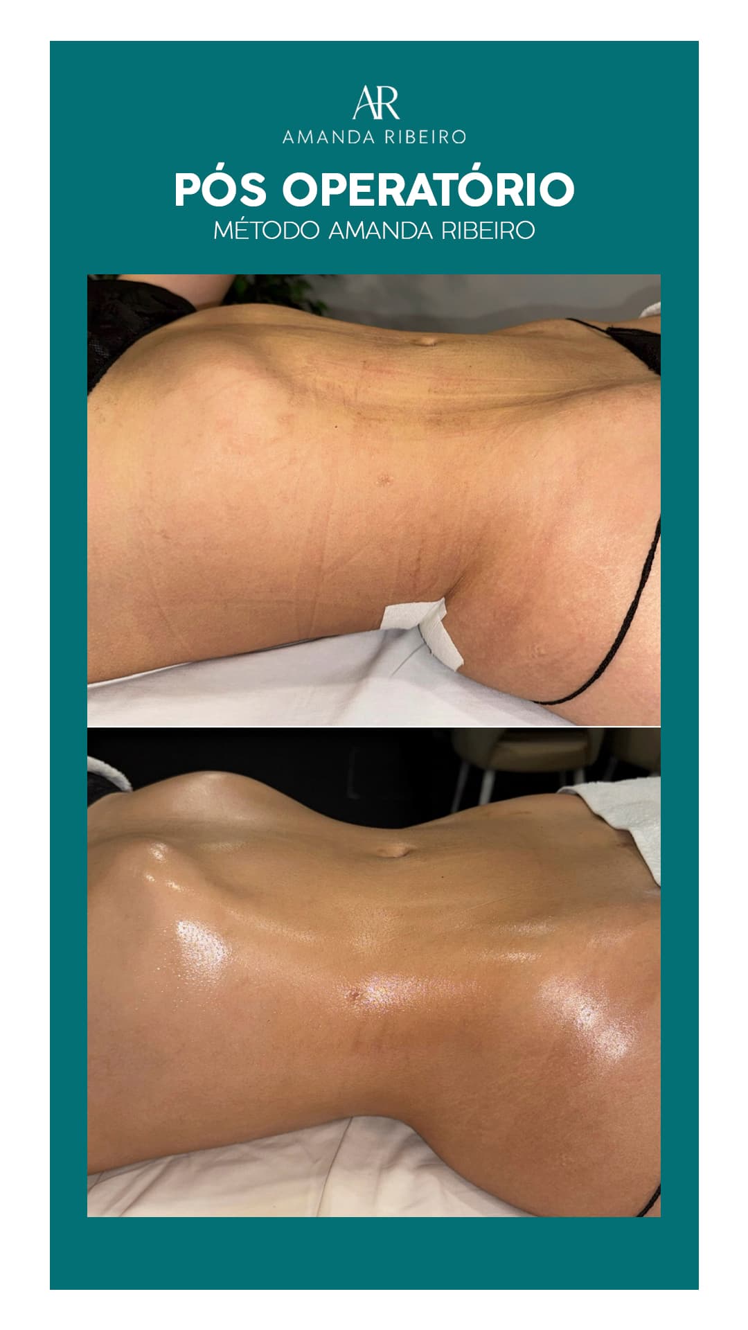 Resultado antes e depois - Pós Operatório